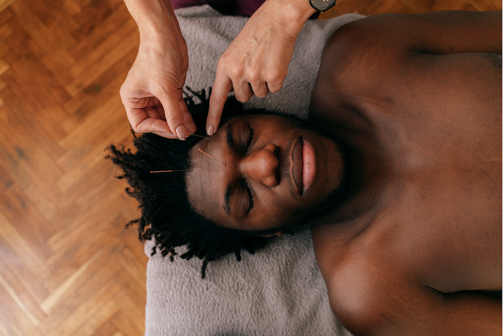 Patient with acupuncture needles in face