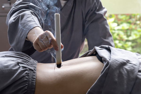 moxibustion